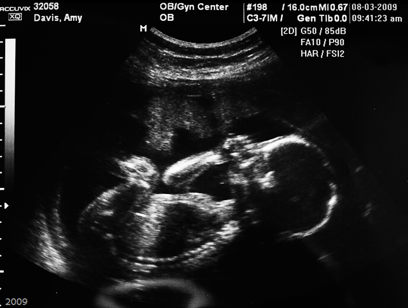 Baby at 20 weeks